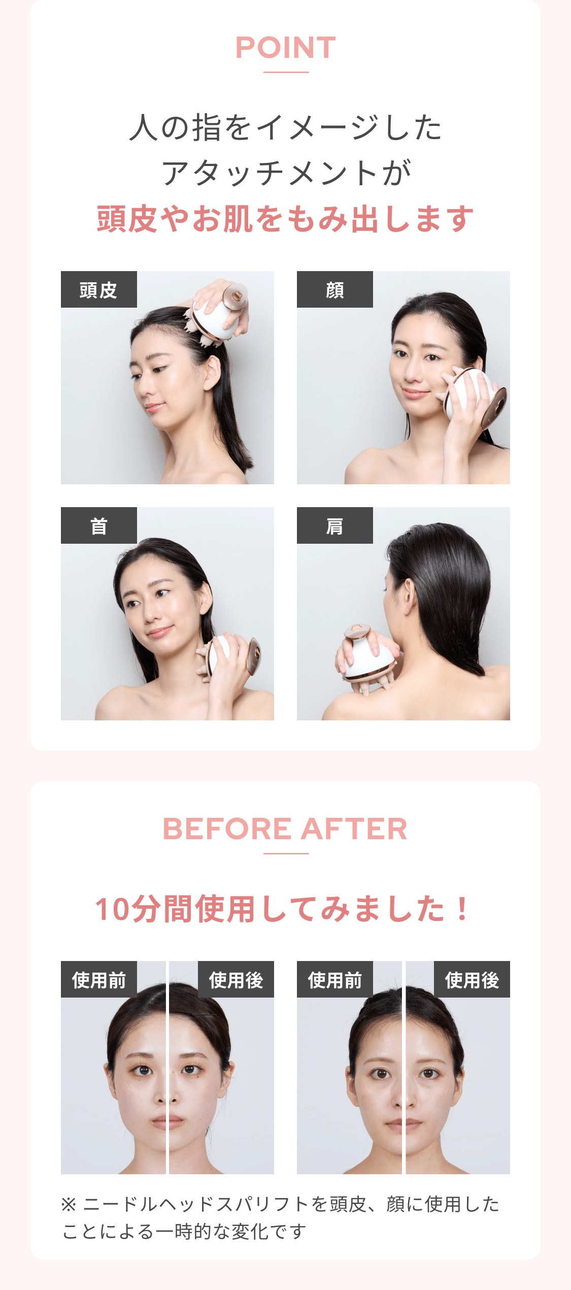 レンタル】ミーゼ(mysé) ヘッドスパ ニードルヘッドスパリフト MS31N