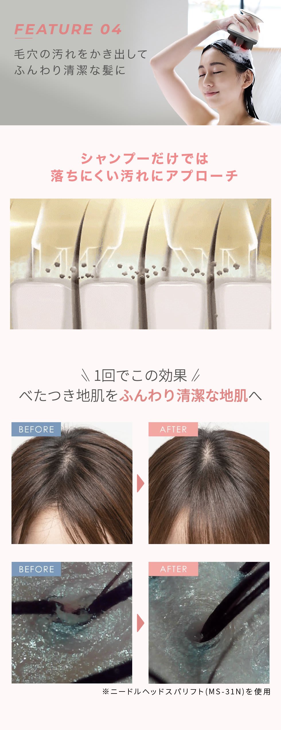 レンタル】ミーゼ(mysé)・ニードルヘッドスパEMSのサブスク・お試し