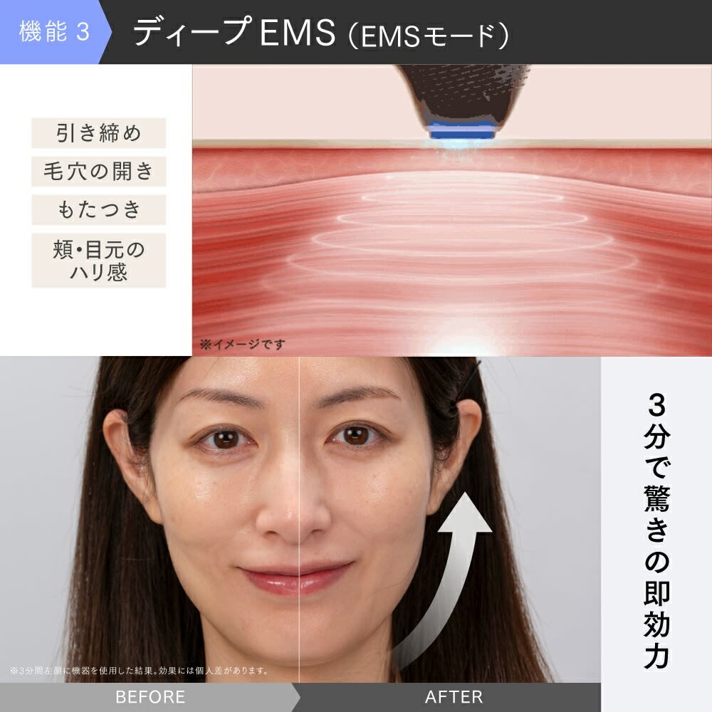 【ちーちゃん】開封のみ新品未使用マイトレックス　ミライワン ちーちゃん】開封のみ新品未使用マイトレックス ミライワン MYTREX